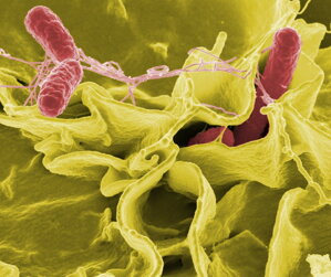 Ako sa zbaviť pseudomonas v pitnej vode